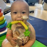 Burger Benefit Tonight for 18-Month-Old Thomas Zempel